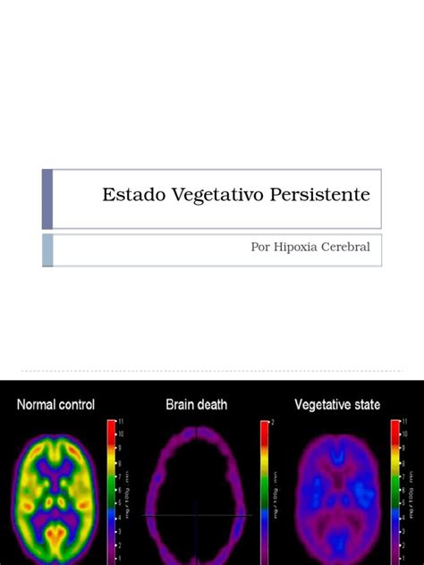 estado vegetativo persistente pdf